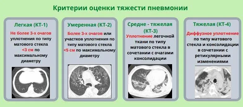 Уплотнения паренхимы по типу матового стекла