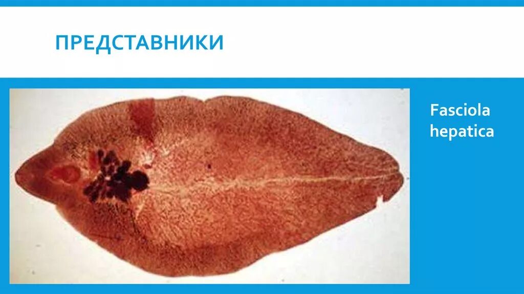 Печеночные сосальщики кишечник. Печеночный сосальщик (Fasciola hepatica). Фасциола выделительная система. Строение фасциолы печеночной. Fasciola hepatica препарат.