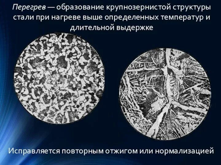 Пережог металла микроструктура. Микроструктура после закалки и отпуска. Пережог металла дефект. Сталь 45 структура. Дефекты при термической обработке.