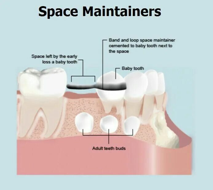 Fix space