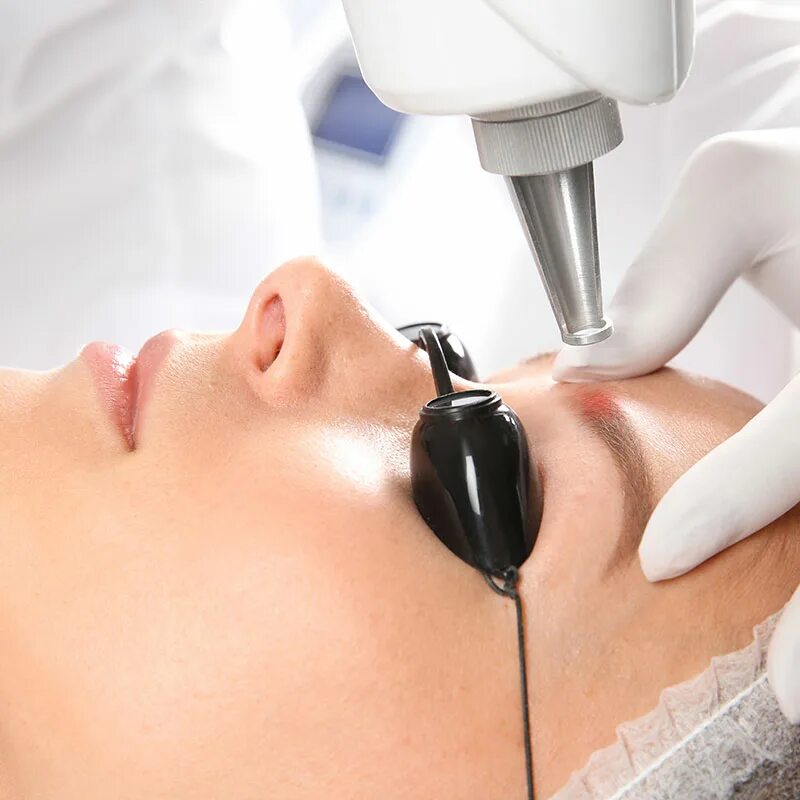 Лазеротерапия в косметологии. Удаление лазером сочи. Лазерное удаление тату в славянске на кубани. Удаление лазером сочи. Лазерная дерматология.