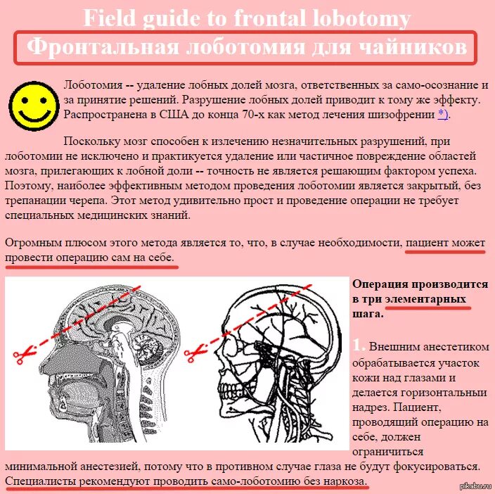 Лоботомия песня. Трансорбитальная Лоботомия. Фронтальная Лоботомия. Префронтальная лейкотомия.