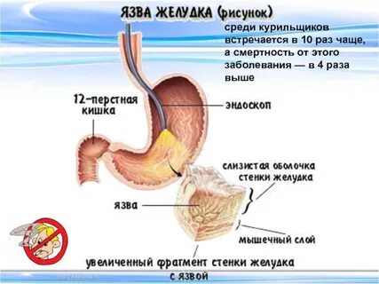 Желудка сигарет