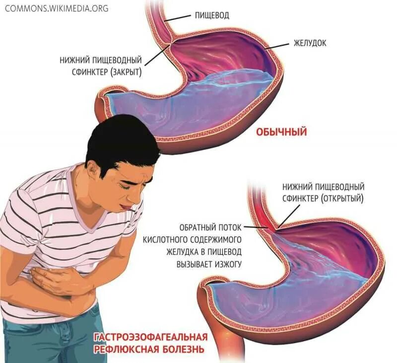 Сухость зуд и жжение во влагащение. Почему жжет внутри. Почему жжет внутри. Почему жжет внутри. Признаки воспаление мочеиспускательного канала.