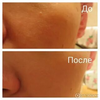 Как распарить кожу