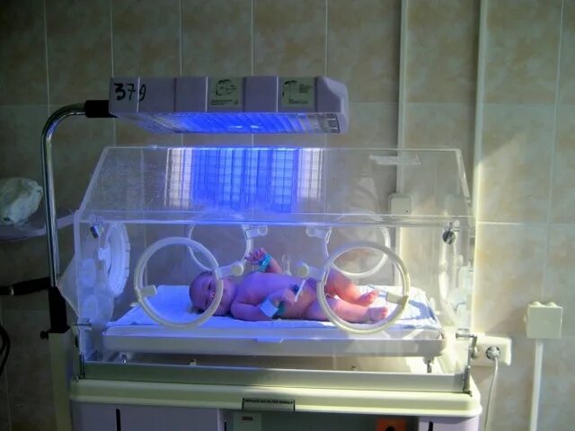 Барокамера для новорожденных. Недоношенный ребёнок в кувезе. Инкубатор для интенсивной терапии новорожденного babyguard i-1120. Транспортировка недоношенного. Кювез для новорожденных недоношенных детей.