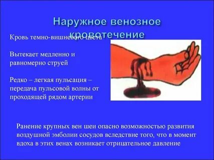 Опасность венозного