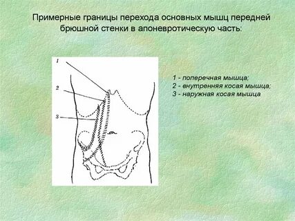 Грыжа передней брюшной стенки