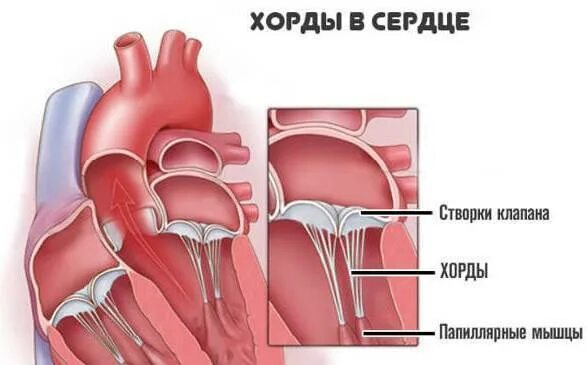 Наличие хорды у человека. Дополнительная хорда в сердце. Аномальная хорда в сердце.