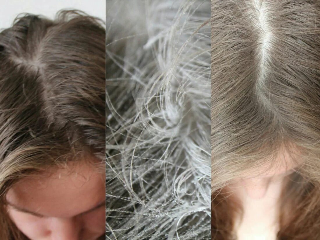 Волосы после сухого шампуня. Шампунь для сухих волос. Сухой шампунь для волос до и после. Сухой шампунь для волос результат. Как наносить сухой шампунь