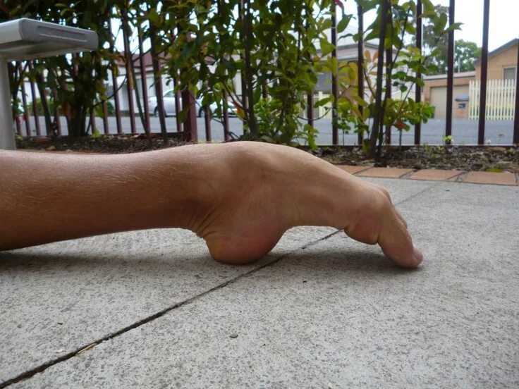 Foot arch. Foot arch. Medial longitudinal arch. Ступни high arches. Энн арчер feet.