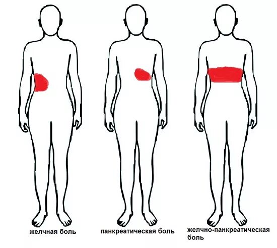 Хронический панкреатит локализация боли. Острый панкреатит локализация боли. Локализация боли при панкреатите. Иррадиация боли при остром панкреатите.