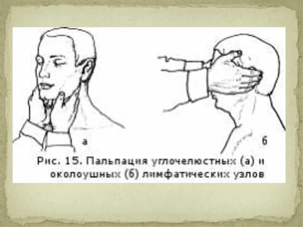 Пальпация затылочных лимфатических узлов. Околоушные лимфоузлы пальпация. Пальпация поднижнечелюстных лимфоузлов. Подколенные лимфатические узлы пальпация. Лимфоузлы кисти