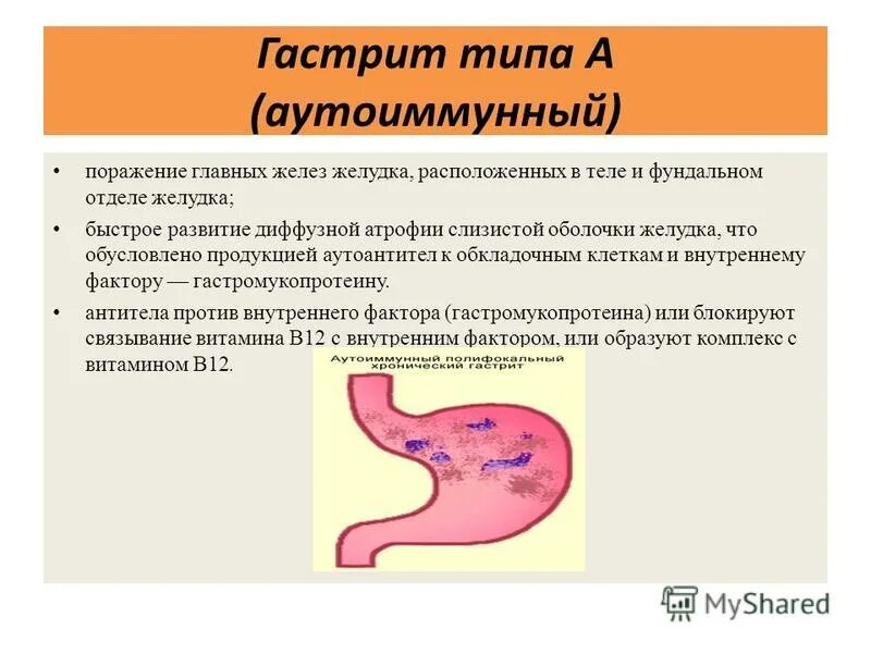 Хронический диффузный атрофический гастрит. Хронический гастрит типа а. Гастрит типа а клинические проявления. Хронический атрофический гастрит типа а. Атрофический латынь