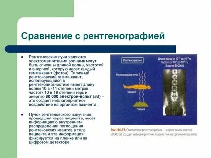 Гамма рентгеновское