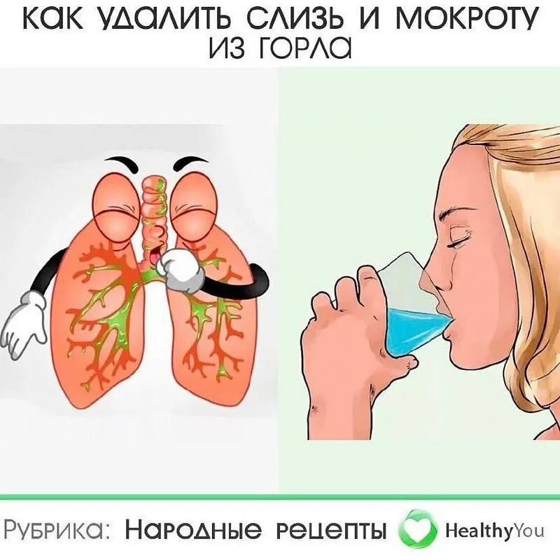 Сопли в горле как избавиться. Как избавиться от мокроты. средство от слизи и мокроты.