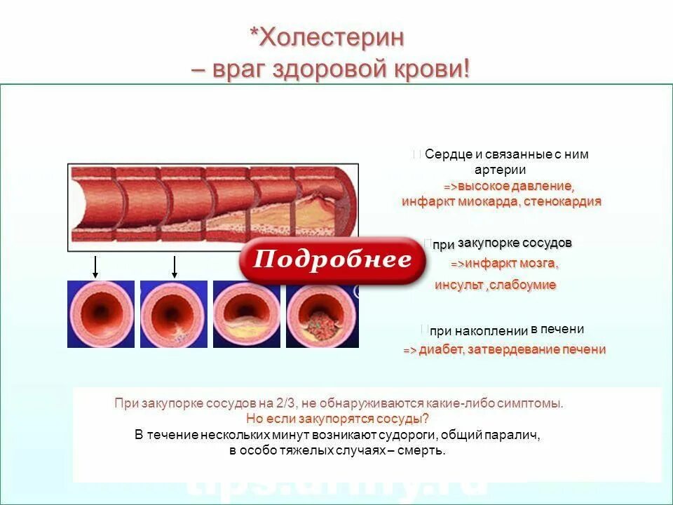 Чем чистят сосуды от холестериновых. Повреждение эндотелия сосудов. Механизм проникновения холестерина в эндотелий. Проникновения холестерина в эндотелий сосудов. Препараты очищающие сосуды от холестериновых бляшек.