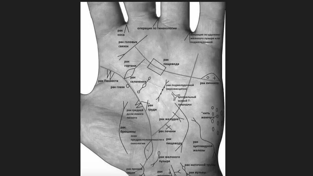 Хиромантия. Хиромантия по руке. Линии заболевании на линии рук. Хиромантия болезни по руке.