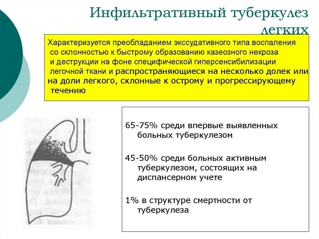 Фаза распада легких. Фаза распада инфильтративного туберкулеза. Инфильтративный туберкулез стадии на рентгене. Инфильтративный туберкулёз с1 с2 с6. План лечения инфильтративного туберкулеза.