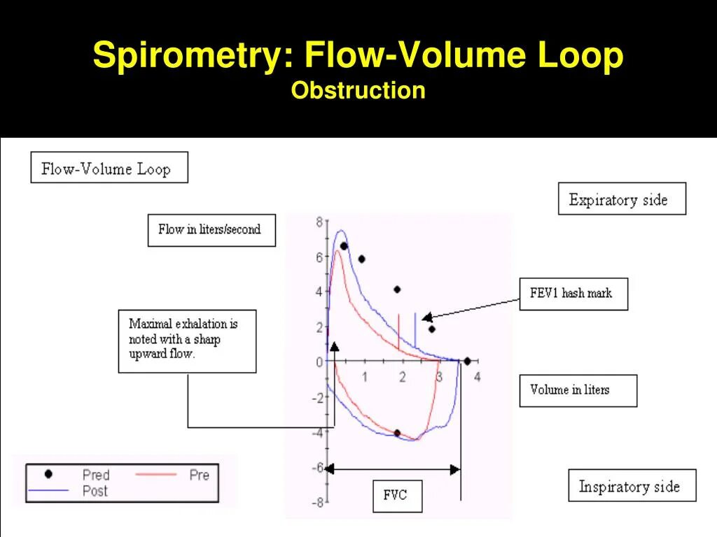 Flow loop. Спирометрия. спирометрия показатели. flow volume расшифровка. спирометрия картинки.