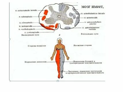 Заболевание спинного мозга признаки