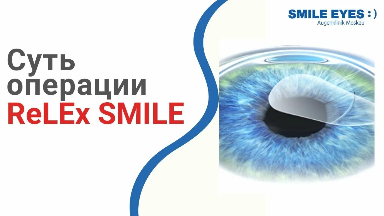 Коррекция зрения методом смайл. RELEX smile лазерная коррекция зрения. Технология RELEX smile. Коррекция RELEX smile. Метод smile коррекция зрения.