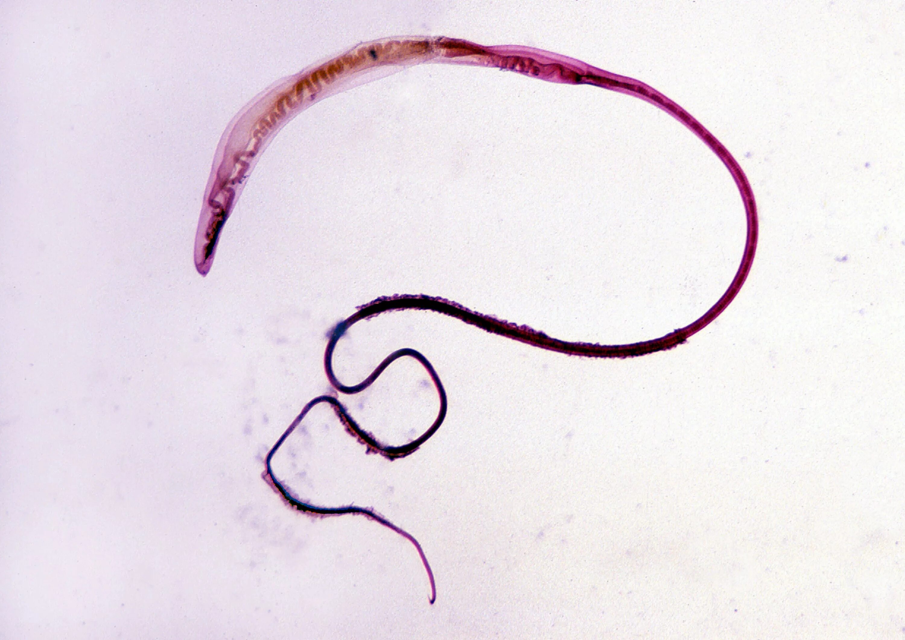Стадии жизненного цикла острицы. Черви паразиты глисты и гельминты. Кошачьи глисты анкилостома. У всех ли людей есть глисты. Черви-паразиты нематоды.
