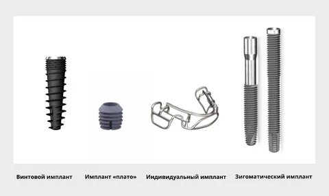 Винтовые импланты