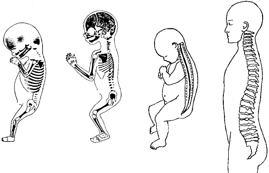 Скелет зародыша человека. Скелет туловища скелет новорожденного. Онтогенез костной системы. Стадии развития скелета человека анатомия. Женщина с нарушением в развитии скелета