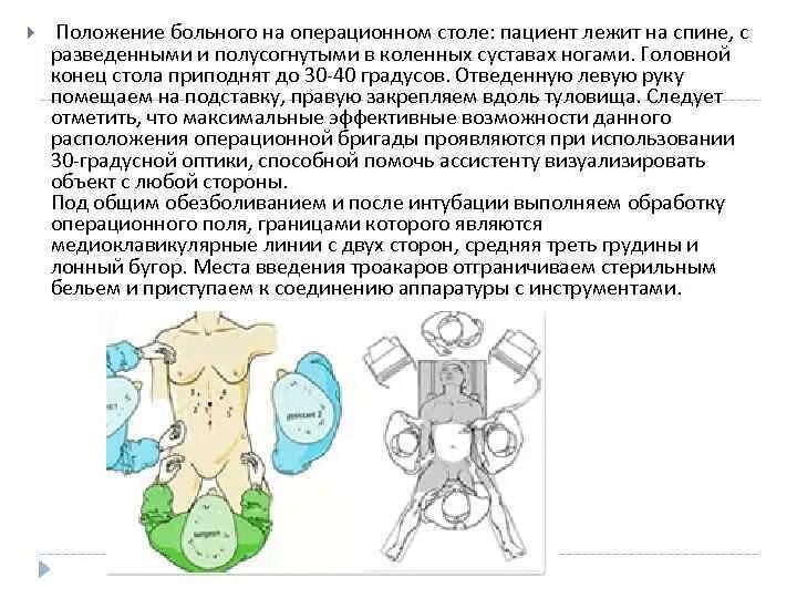 Положение больного на столе. Позиции пациента на операционном столе. Положение больного на операционном столе. Позы пациента на операционном столе. Положение на спине на операционном столе.