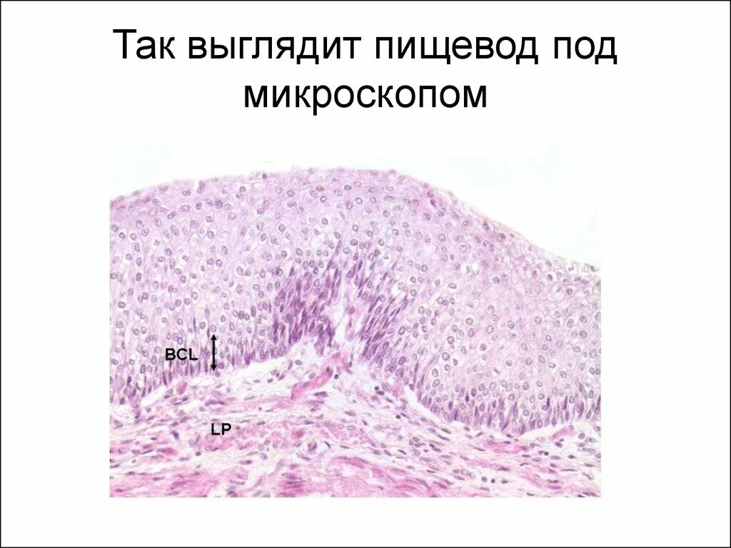 Клетки пищевода. Эпителий пищевода гистология. Поперечный срез пищевода гистология. Эпителий пищевода препарат. Многослойный плоский неороговевающий эпителий пищевода гистология.