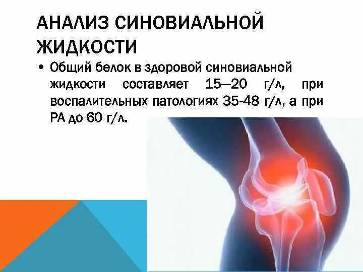 Содержит суставную жидкость. Исследование синовиальной жидкости коленного сустава. синовиальная жидкость при ревматоидном артрите. исследование синовиальной жидкости норма. референтные показатели синовиальной жидкости.