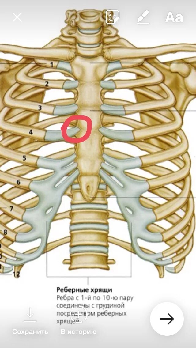 Болит ребро спереди при нажатии. Синдром скользящего реберного хряща. Синдром скользящего ребра. Хрящевые отростки ребер. Кости рёбер с грудиной.