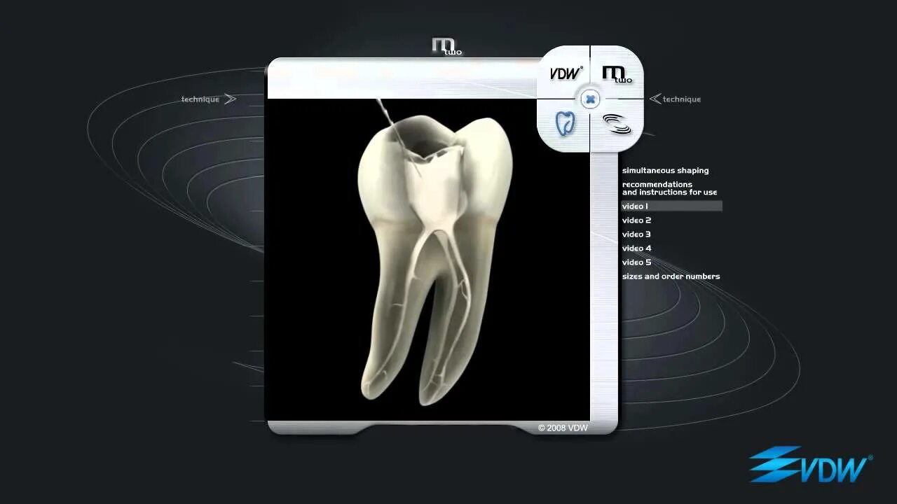 X shape 1