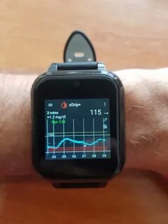 Xdrip
