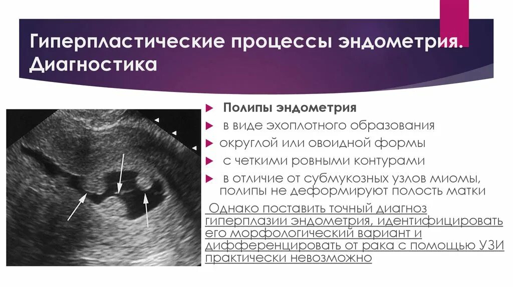 Новообразование эндометрия. Атипическая гиперплазия эндометрия УЗИ. Атипическая гиперплазия эндометрия диагноз. Гиперпластические процессы эндометрия УЗИ.