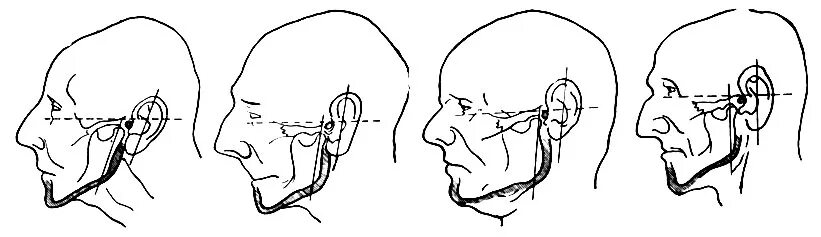 повороты головы в стороны. правильная посадка головы. где находится середина плеча. проблемы с осанкой. боль в затылке.