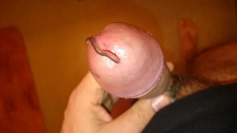 Worm In Penis Porn.