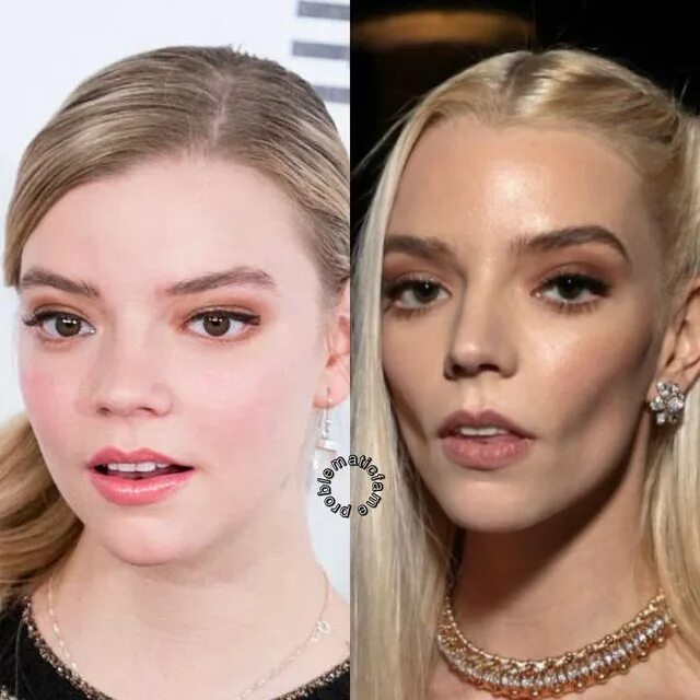 Anya Taylor-Joy - Leaves The Bowery Hotel in NYC 02/18/2020 Anya taylor joy, Any