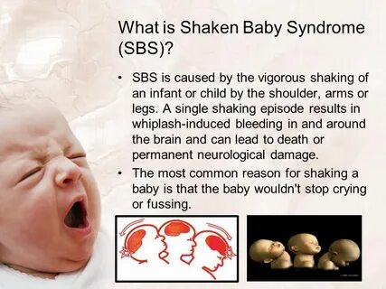 Shaken baby