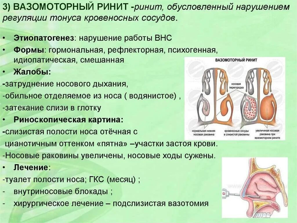 Истории болезни ринит. Вазомоторный ринит цвет слизистой оболочки. Вазомоторный ринит Триада симптомов. Вазомоторный аллергический ринит симптомы. Вазомоторный ринит носовые раковины.