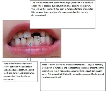 Floors have teeth