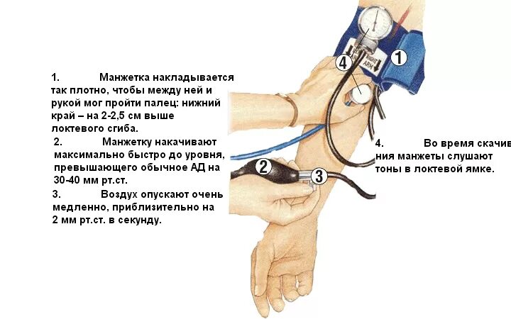 Повышенное давление утром после сна причины. Измерение артериального давления механическим тонометром алгоритм. Алгоритм измерения давления механическим тонометром. Измерение артериального давления механическим тонометр ам алгоритм. Как измерять давление ручным тонометром.