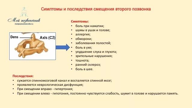 Смещение с1. Смещение позвонков шейного отдела с1 с2. смещение 1-2 шейных позвонков симптомы. смещение 2 позвонка шейного отдела симптомы. сдвинут шейный позвонок симптомы.