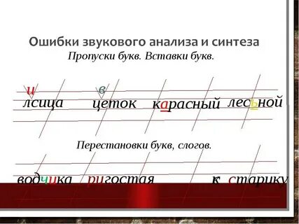 При написании слов пропускаю буквы