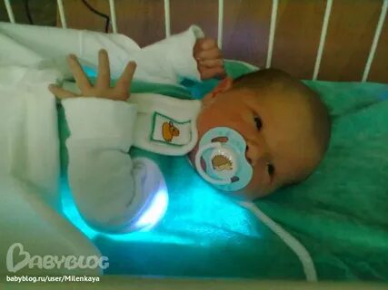 Новорожденные лежат под лампой при желтушке