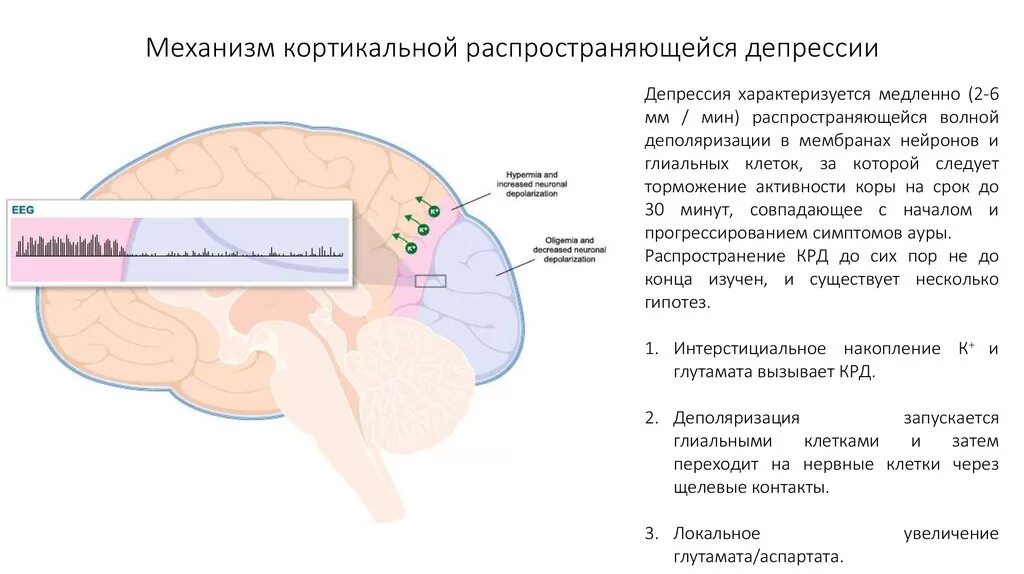 Карта депрессии. Распространение корковой депрессии Leo. Патогенез депрессии. Головной мозг при депрессии. Патогенез мигрени.