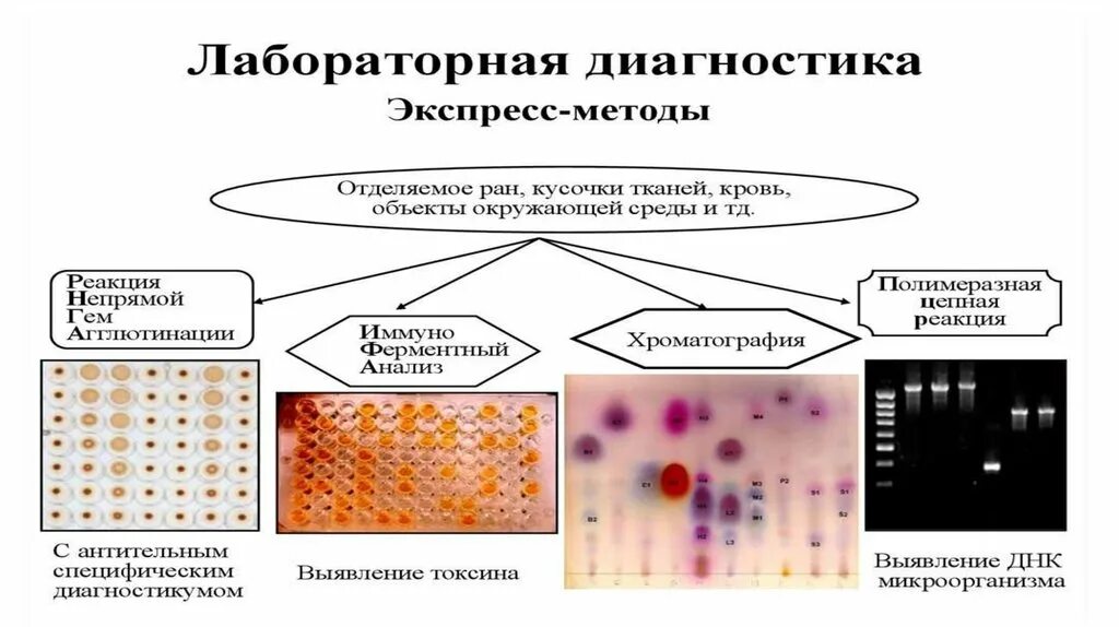 Лабораторная диагностика коклюша и паракоклюша микробиология. Схема исследования на коклюш. Микроскопический метод коклюш. Микробиологическая диагностика возбудителя коклюша.