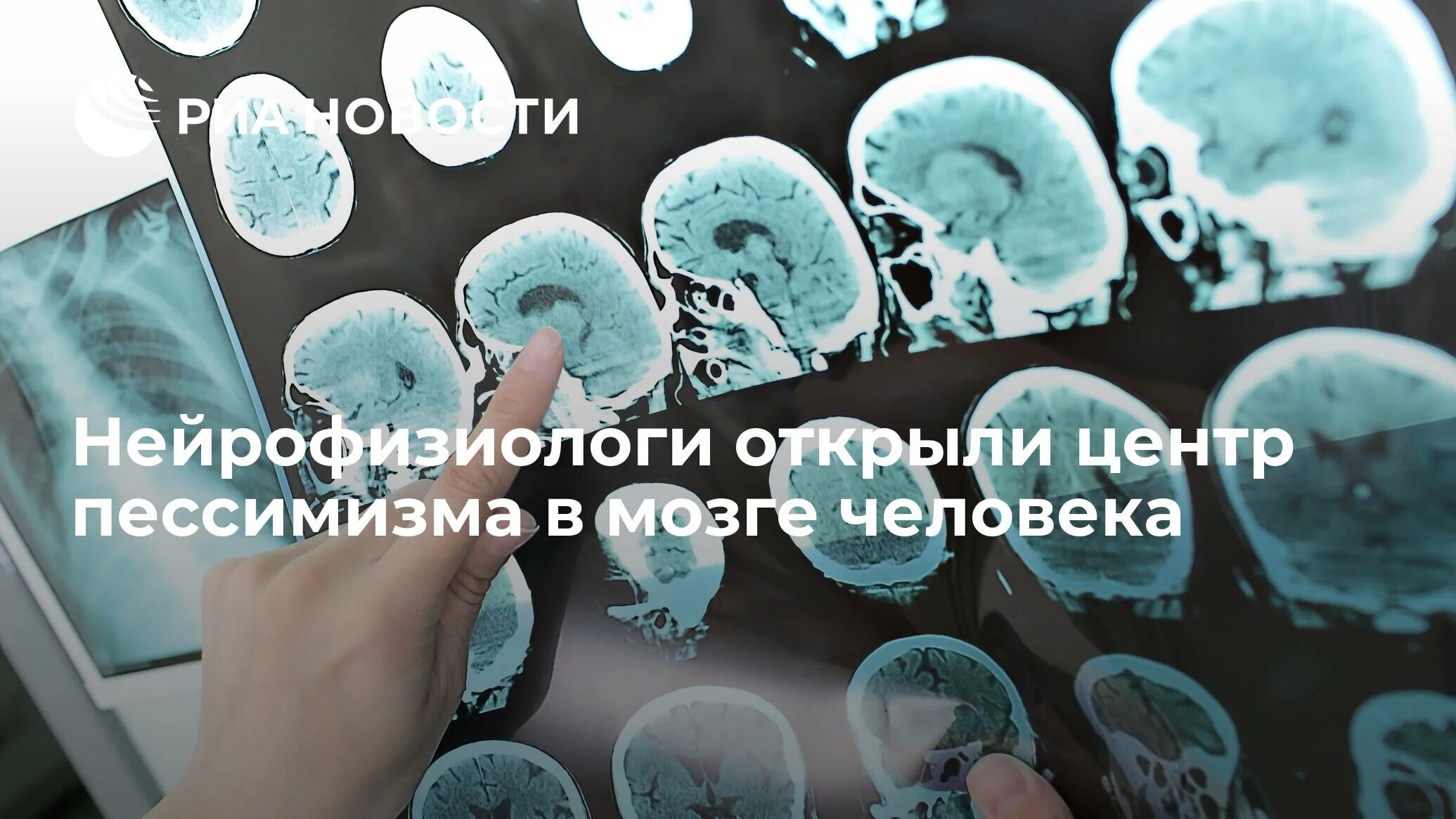 Старение мозга причины. Старение мозга. центр рассеянного склероза казань. центр рассеянного склероза в германии. тест на старение мозга.