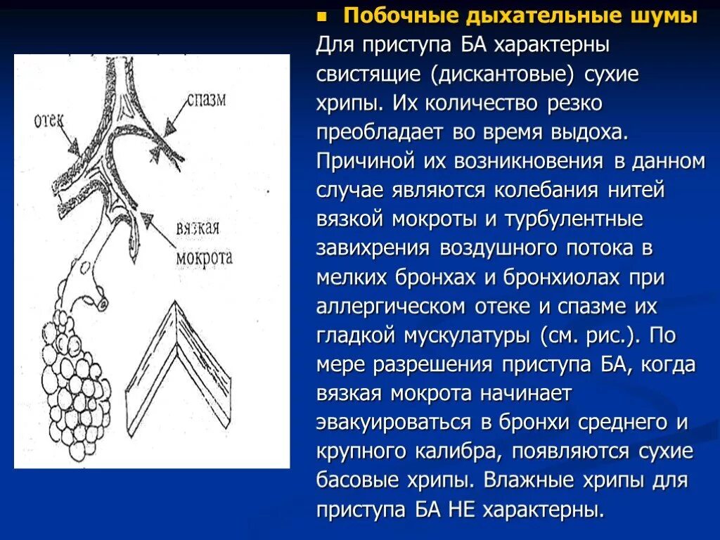 Сухие дискантовые хрипы. Побочные дыхательные шумы хрипы. Сухие свистящие хрипы. Сухие хрипы характерны для.